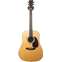 Martin D35E LR Baggs Anthem Re-imagined Front View